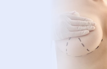 Surgical Management Thumbnail min